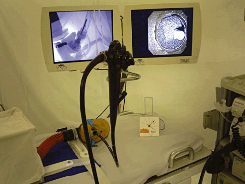 Endoscopi Retrograde Cholangio Pancreatografi (ERCP)